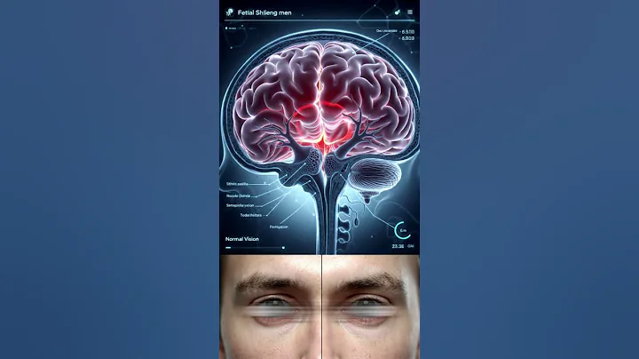 What If You Didn’t Sleep for 3 Days? #yourbody #facts #infotainment #zackdstyle