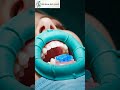 Dentist SAVES a Tooth Everyone Wanted to REMOVE! 😱🦷 #shorts #dentist #rootcanal #satisfying