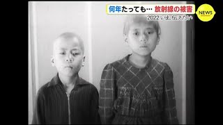 「髪は抜け、腕は糸のように…」 9歳と7歳の姉弟もその後 亡くなった　続く放射線の被害 ～広島の放送局に残る映像から　原爆投下77年～