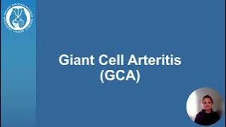Understanding Giant Cell Arteritis (GCA): Causes, Symptoms, and Treatment