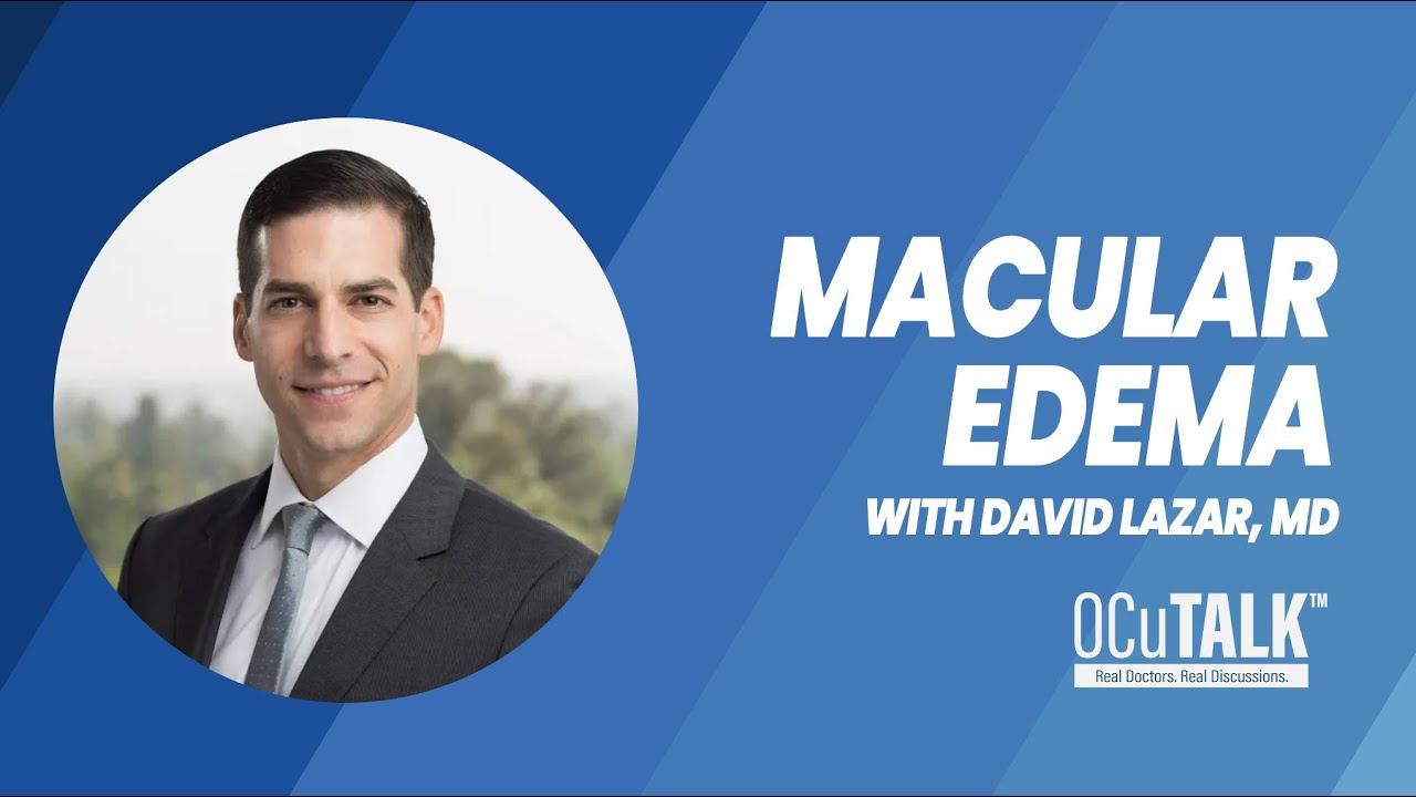 Macular Edema | What it is, Risk Factors, and Treatment Options with David Lazar, MD