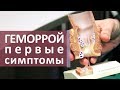 Признаки геморроя. 😨 Первые признаки геморроя и трещины заднего прохода. МОСИТАЛМЕД