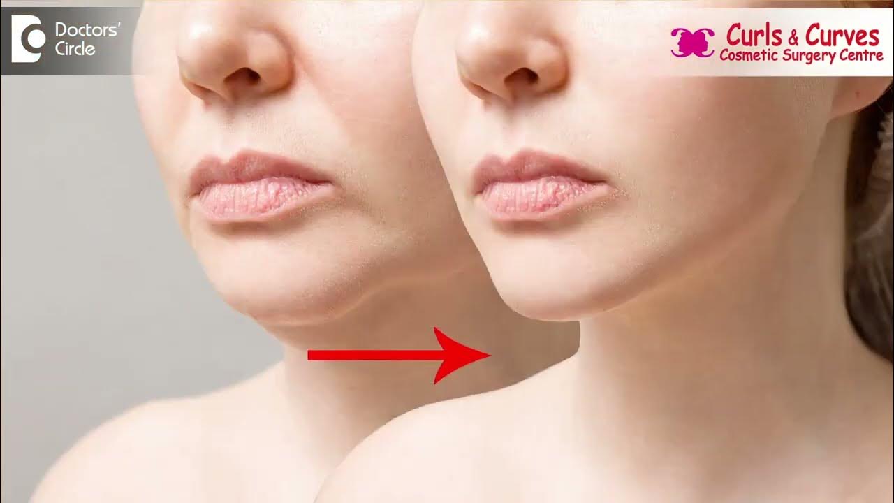 Dr Curves Advanced Plastic Surgery Solutions Facelift Procedure Steps | Dr. Girish A C | Curls & Curves Cosmetic