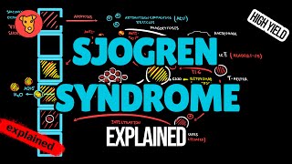 Sjogren syndrome Pathogenesis EULAR Guideline Diagnostic Criterias Treatment Explained