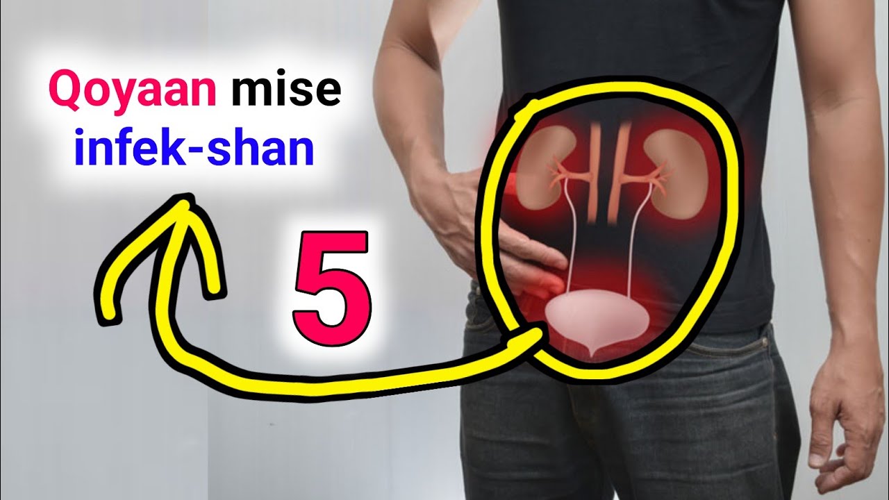 infek-shanka ku dhaca  kiliyaha iyo kaadi  mareenka Calaamadaha lagu garto iyo talooyin muhiim ah..