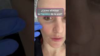 👍 ¿Cómo combatir la flacidez facial? Mi experiencia personal #rejuvenecimiento #flacidez 👍 ¿Cómo combatir la flacidez facial? Mi experiencia personal #rejuvenecimiento #flacidez