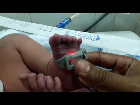 Video: Why Does The Baby's Nasolabial Triangle Turn Blue