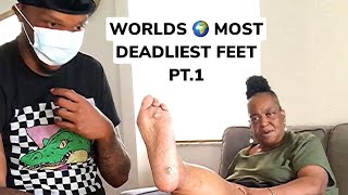 Worlds Most Deadliest Feet Pt 1 My Feet Are Killing Me 