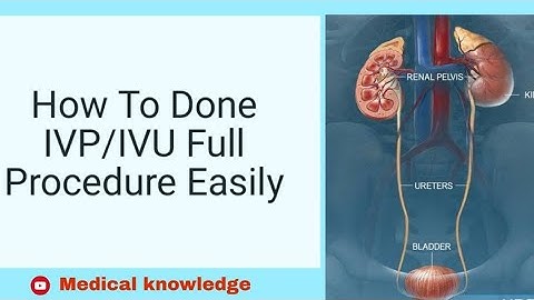 IVP | INTRAVENOUS PYELOGRAPHY | RADIOLOGY PROCEDURE |ASIF MALIK