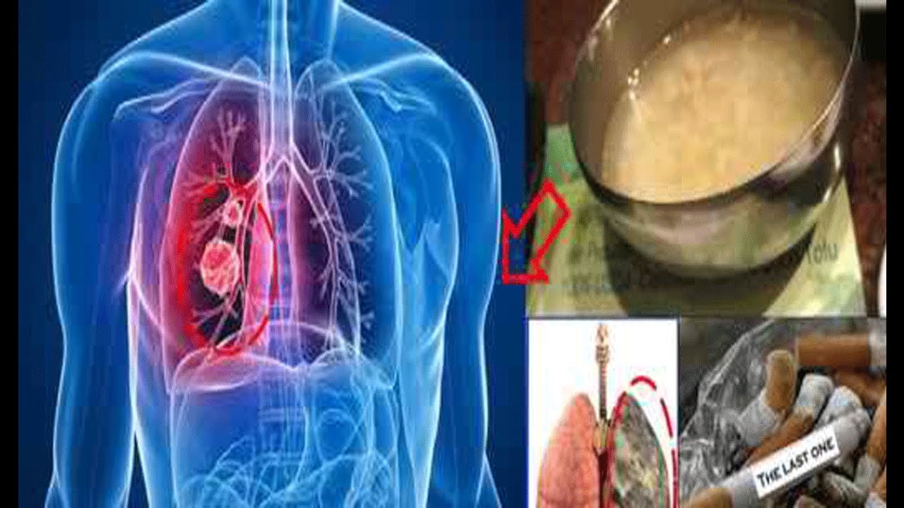 if-you-smoke-for-more-than-5-years-this-recipe-will-easily-clear-your