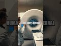 The Advent of Magnetic Resonance Imaging (MRI): A Medical Revolution