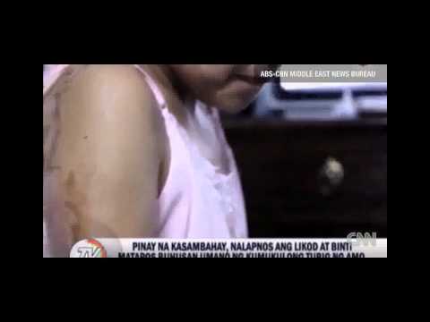 18+ VIDEO of Scalded Filipino Maid in Riyadh Go Viral