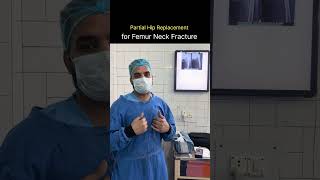 Partial Hip Replacement for Femur Neck Fracture | Orthopedic Surgeon Explains