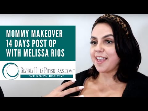 Tummy Tuck Weight Loss Journey - Melissa Rios