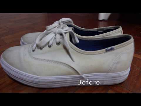 how to get rid of yellow stains on white vans