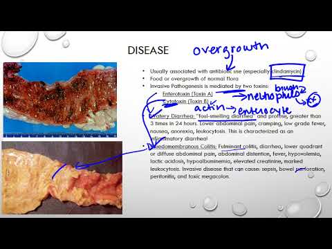 Видео: Bacillus Coagulans GBI-30 (BC30) подобрява индексите на Clostridium Difficile-индуцираният колит при мишки