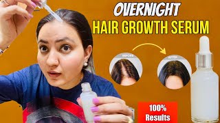 DIY Overnight Hair Re-growth Serum : गंजेपन, Receding Hairline, Bald Patches हल्के बालों को करें घना