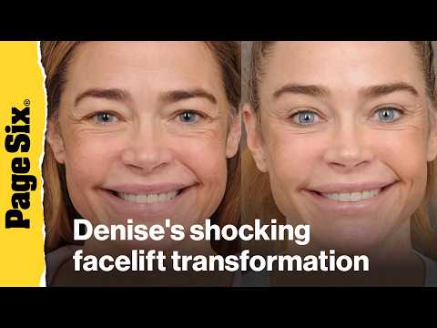 Unseen Denise Richards Photos: The Leak Explained