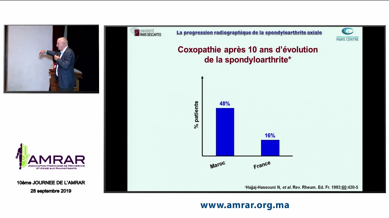 AMRAR - La progression radiographique de la spondyloarthrite axiale, Maxime DOUGADOS - 280919