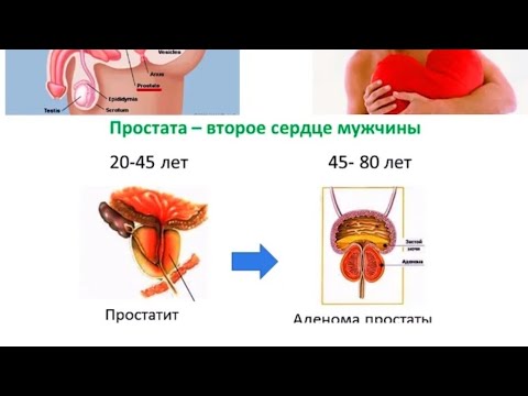Можно Ли Заниматься Сексом При Аденоме Можно Ли Заниматься Сексом При Аденоме