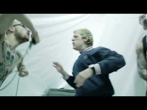 Glossectomy Video