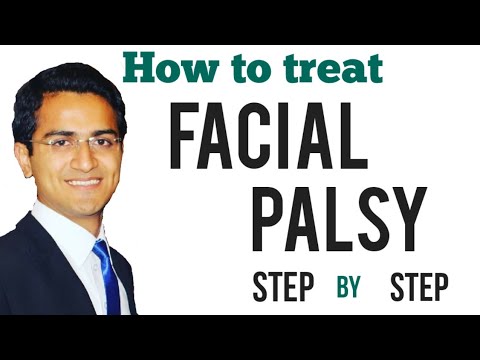Facial palsy (Bell&#39;s Palsy) Treatment, Upper and Lower motor neuron (UMN vs LMN), Symptoms, USMLE