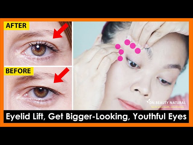 Eyelids Sagging Exercises & Massage to Get Bigger Looking, Youthful Eyes, Tighten droopy eyelids.