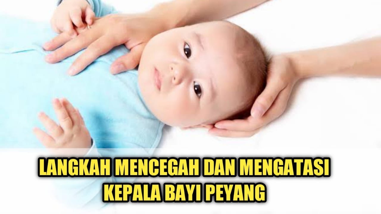 Cara Mencegah dan Mengatasi Kepala Bayi Peyang