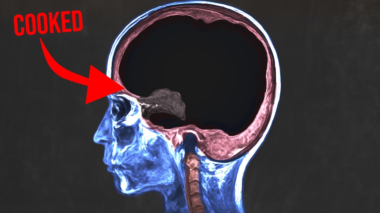 A man asked AI for health advice and it cooked every brain cell - YouTube
