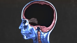 A man asked AI for health advice and he ruined his life