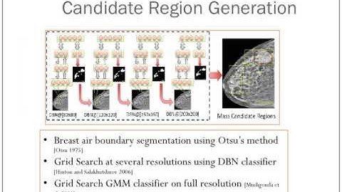 Automated Mass Detection in Mammograms using Deep Learning