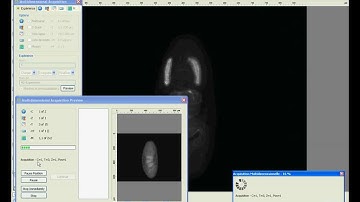 AxioVision - 6D - CT