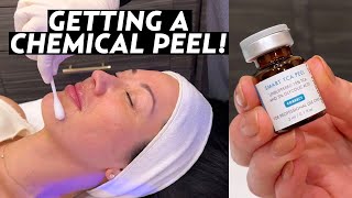I Got a Chemical Peel! My Experience With SkinCeuticals TCA Peel for Hyperpigmentation & Melasma