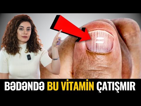 Hansı Vitamin çatışmayanda dırnaqda AĞ LƏKƏ yaranır? BİLMƏK VACİBDİR