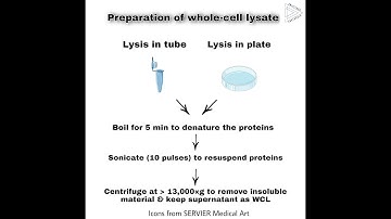 Preparation of whole cell lysate