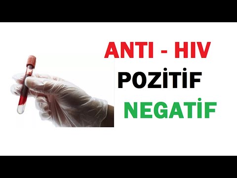 ANTI - HIV TESTİ POZİTİF ve NEGATİF NE DEMEK ?