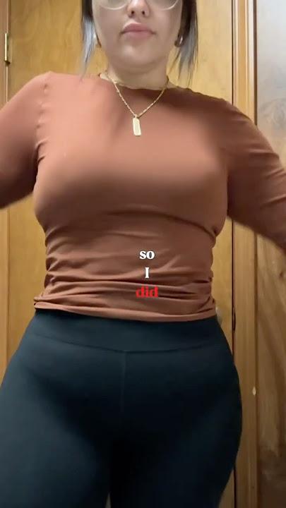 #beforeandafter #gastricsleevesurgery #weightloss #wls