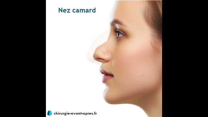 Les 9 types de nez