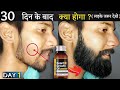 Ustraa Advance Beard Growth Oil Review 2024 | Beard Oil on Amazon with Affiliate Link,Save Money 70%