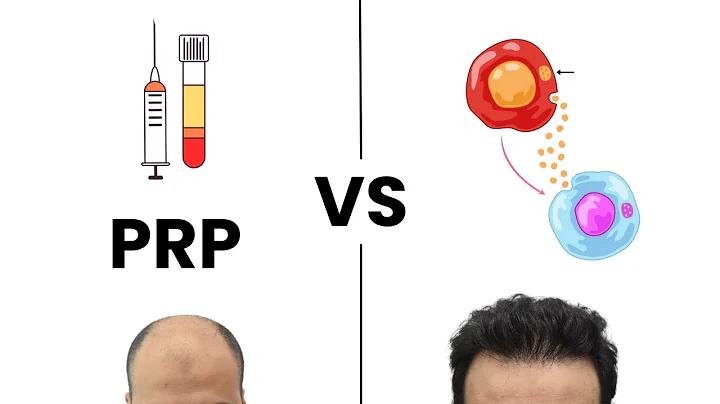 PRP vs Exosomes for Hair Growth | 2025