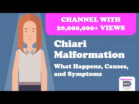 ვიდეო: რომელი chiari malformation არის უარესი?