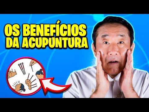 Vídeo: Acupuntura Para Depressão: Isso Realmente Funciona? E 12 Outras Perguntas Frequentes