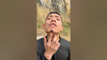 How I Cured a Bug Bite with Yogurt in the Wild | Survival Hacks