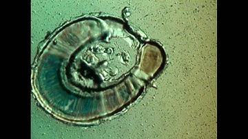 Laser Interaction with Metal