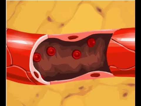 Gas exchange in tissues