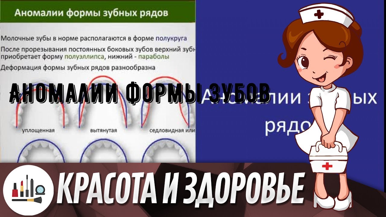 Аномалии формы зубов