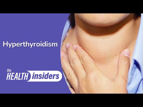 Treating Hyperthyroidism