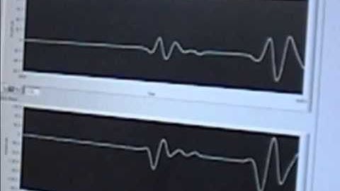 DISP - Digital Signal Processing - Project part 2