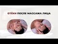 Отеки после массажа лица — как избежать и что делать.