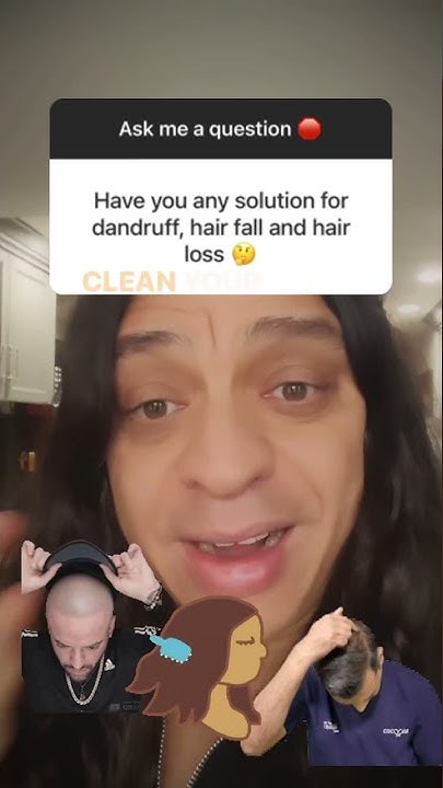 How To Take Care Of Dandruff And Hair Loss Naturally YouTube how-to-take-care-of-dandruff-and-hair-loss-naturally-youtube